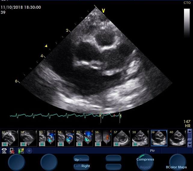 11-month-old-baby-milestones-development